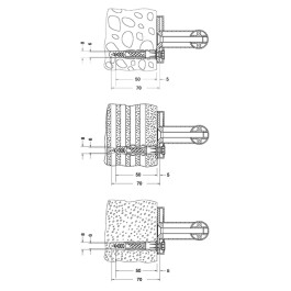 Keuco Befestigungs Set 1 Plan Care 3x Holzschrauben DIN7996-6x70 V2A 3xDübel UX8R 34990000100